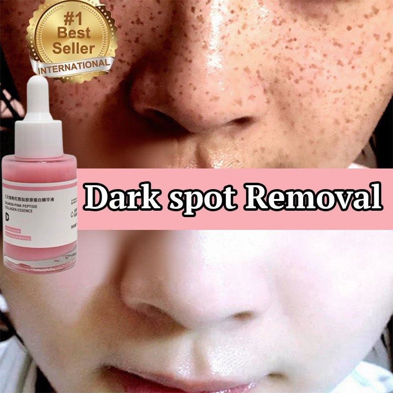 Dark spot serum niacinamide serum dark spot treatment brightening serum whitening 美白祛斑 freckles removal