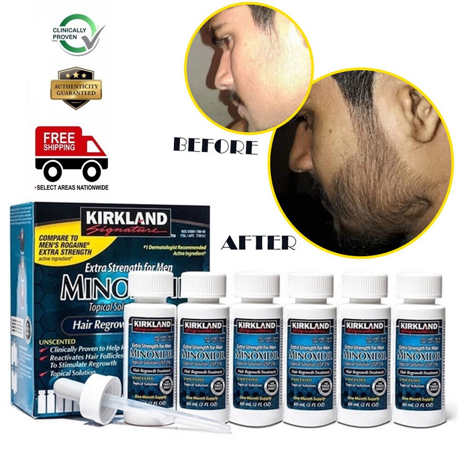 Minox Beard Hair & Scalp Treament Serum 6 Month Supply Excellent Effect