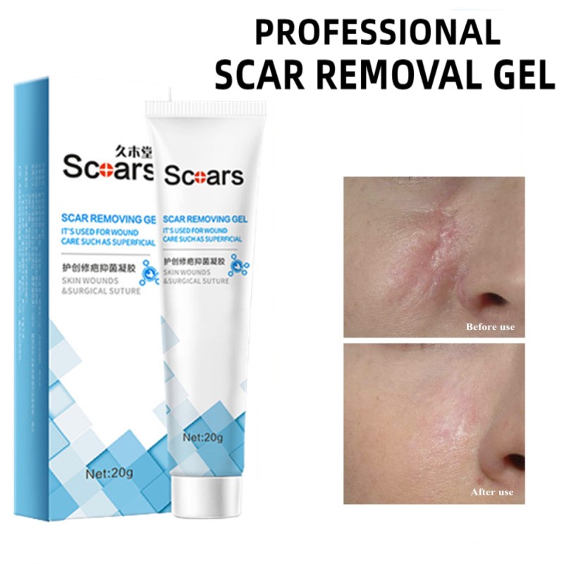 Scar Removal Cream Scar Removal Repair Scar Gel Double Eyelid Scars