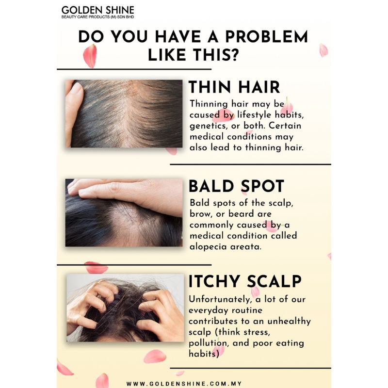 GOLDEN SHINE SRI LETCHIMI HAIR LOSS SOLUTION SHAMPOO 🧴🧴 | Shopee Malaysia
