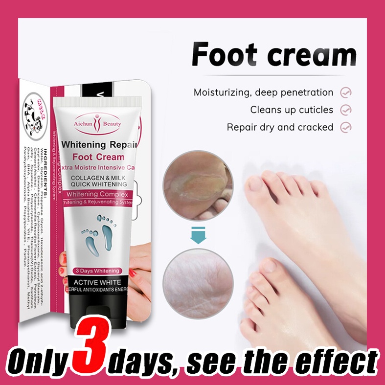 Kaki merekah tumit pecah krim kaki putih Cracked heel Whitening Aichun ...