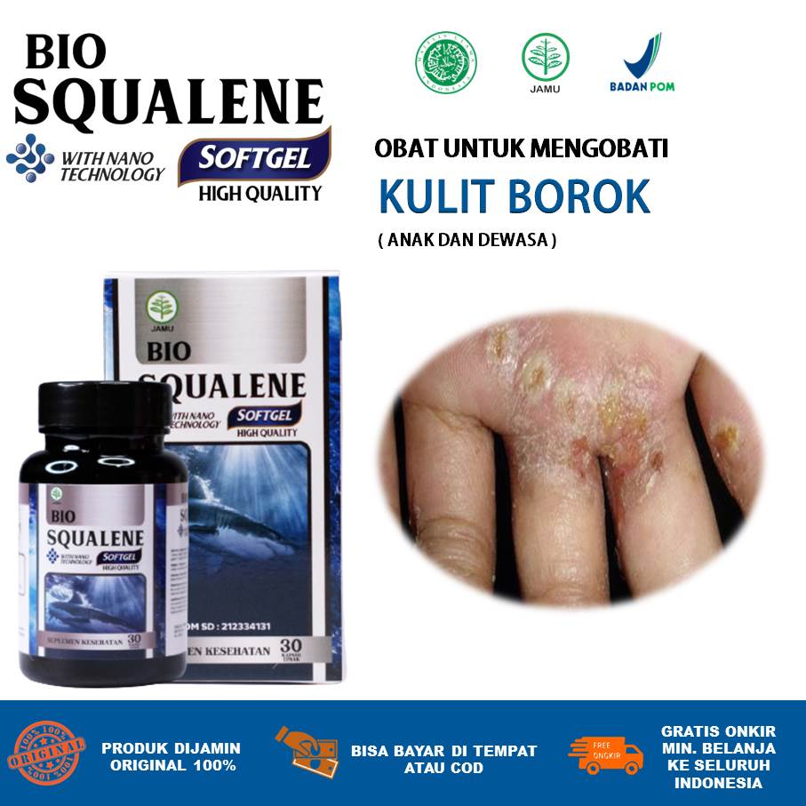 MATA Medicines For Treat Boro, Eczema, Psoriasis, Fish Eyes, Acne