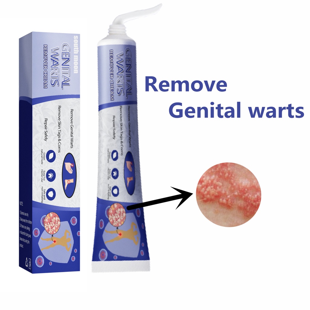 Warts Removal Cream Prices And Promotions Dec 2022 Shopee Malaysia