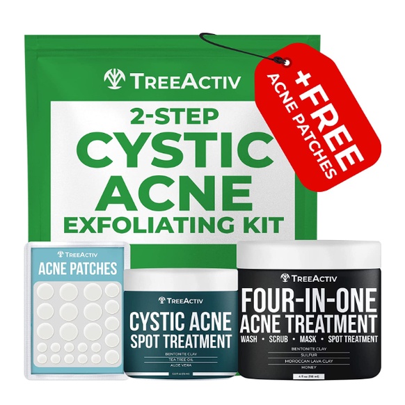 2 Step Cystic Acne Exfoliating Treatment Kit, Sulfur Skin Care Products For Hormonal Acne