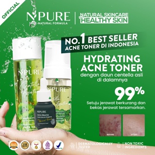 Npure Package Face Wash+Toner Cica 150ml+Serum Biome (Cica/Acne Series ...