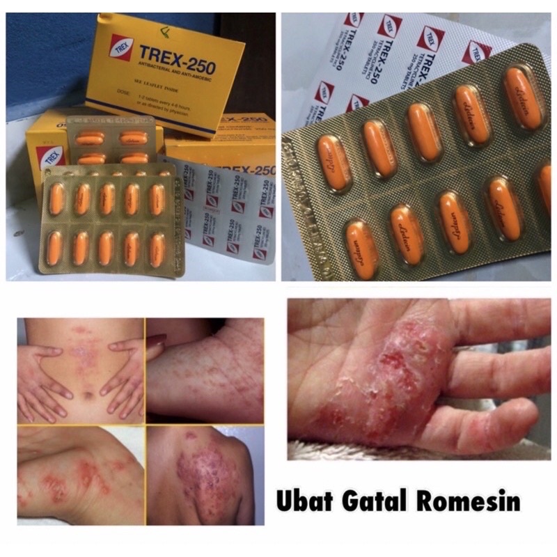 UBAT GATAL ROMESIN/UBAT LUKA MENANAH/KUDIS/KULIT GATAL  Shopee Malaysia