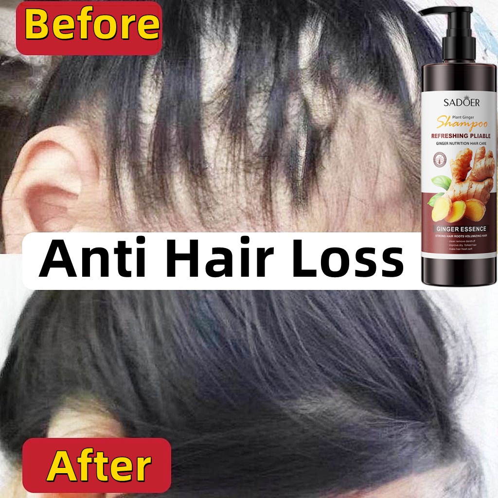 Hair growth Ginger Shampoo Hair loss treatment Shampoo rambut gugur Anti hair  loss shampoo for hair fall 生发洗發水 控油 防脫發 | Shopee Malaysia