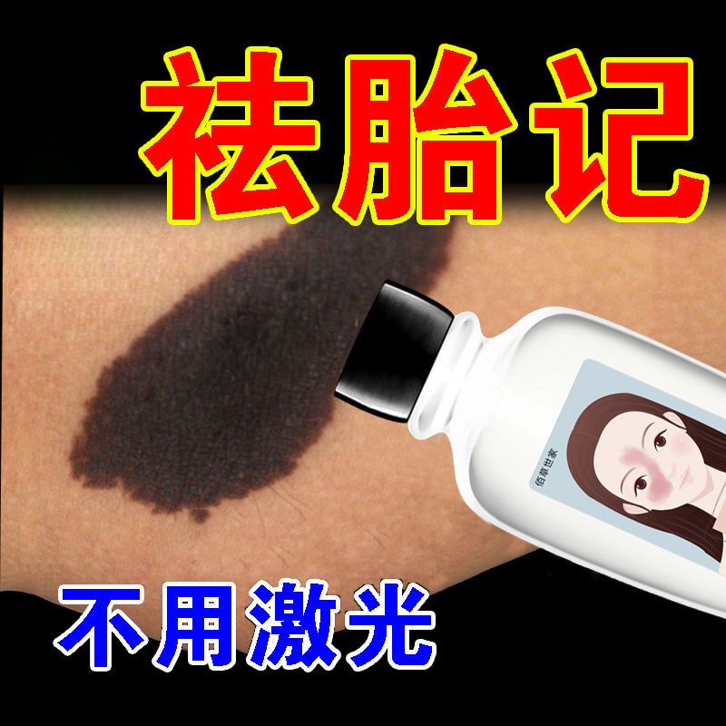 cream to lighten birthmarks