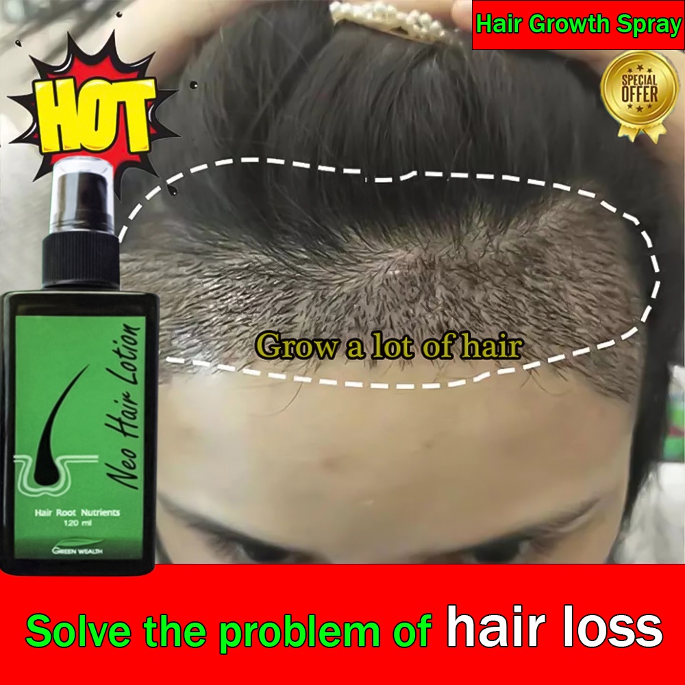 neo hair lotion - Prices and Promotions - Mar 2023 | Shopee Malaysia
