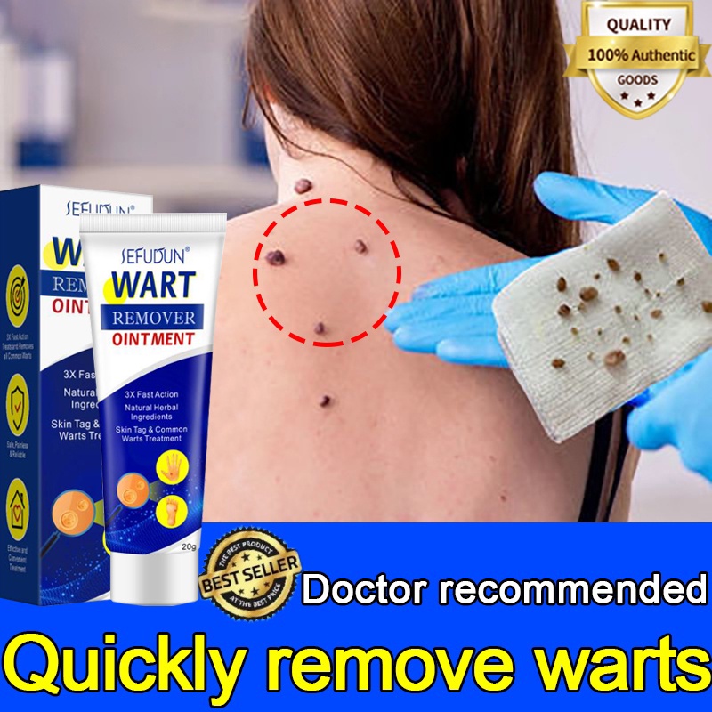 Sefudun 20g Wart Removal Cream Original Cream Quickly Remove Warts Gentle And Non Irritating