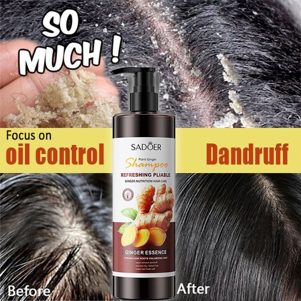 syampoo rambut gugur ginger dandruff shampoo kelemumur hair serum for hair growth treatment Anti