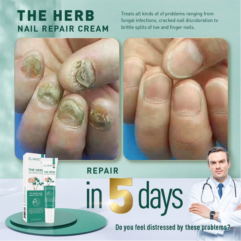Tea Tree Oil For Nail Fungus: How-to, Does It Work, And Is It Safe | Nail  Fungus Repair Cream Nail Repair Gel To Quickly Improve The Appearance Of  Infected, Cracked Nails |