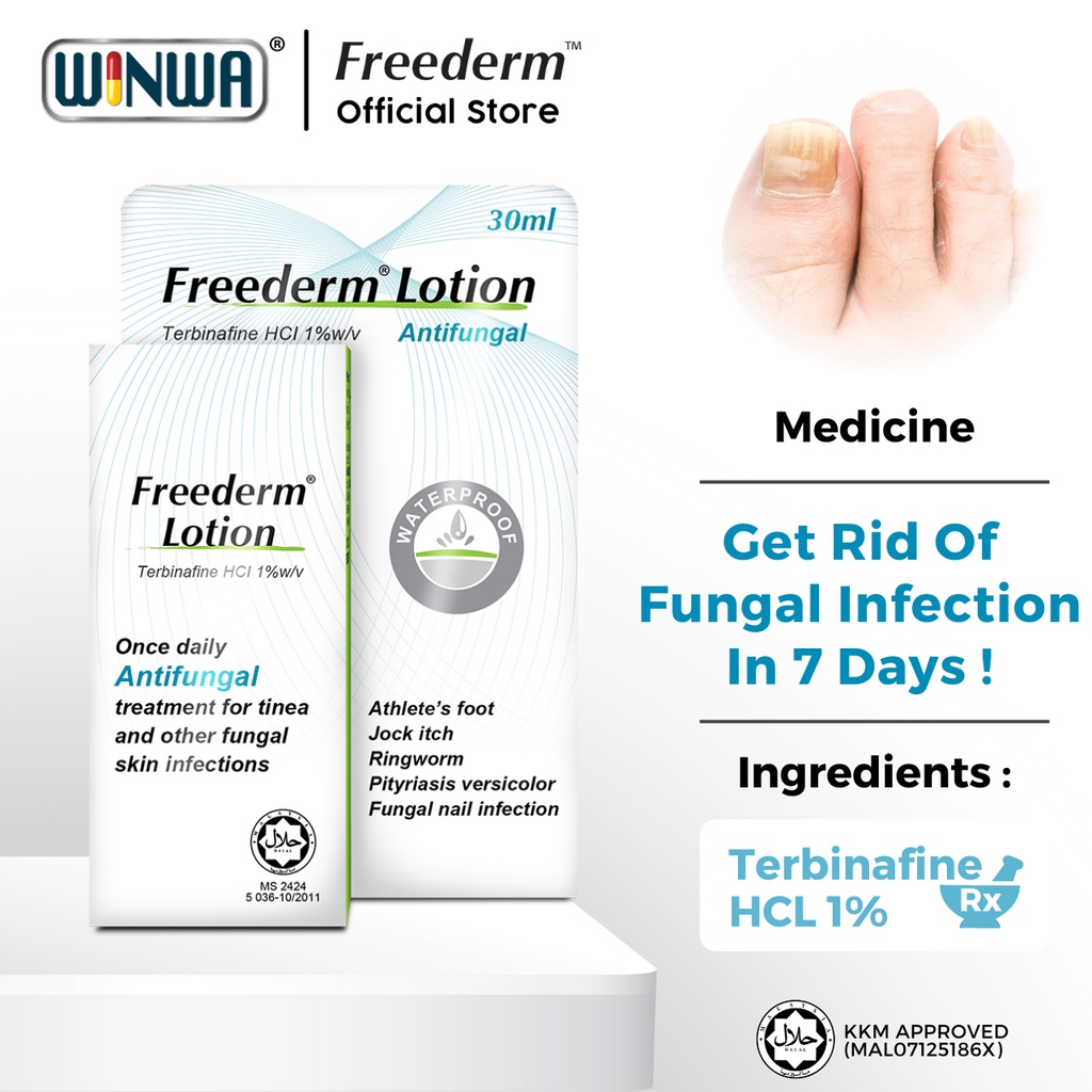 FREEDERM Gel / Lotion Terbinafine For Athlete Foot & Kurap Shopee Malaysia