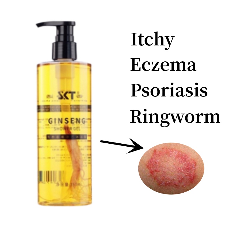 Eczema Body Wash Eczema Treatment sabun gatal kulit eczema Gatal Kulit