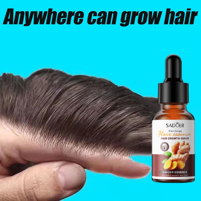 Renew Shampoo MONAT Hair Products Moisturizing Shampoo | 2022 237ml Hair  Growth Spray Ginger Hair Grow Hair Essential Oil Treatment Preventing Hair  Loss Spray Hair-restorer 