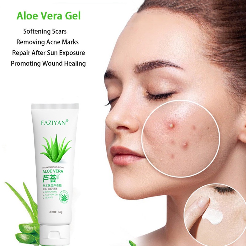 Aloe Vera Gel Face Cream Acne Treatment Soothing Moisture Soothing Gel Repair Acne Marks Spots 