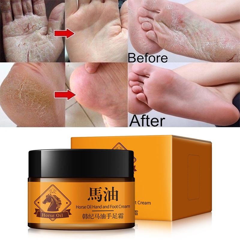 Horse Oil Cream Foot Care Cream 30g Horse Oil Hand Foot Crack Cream Dry ...