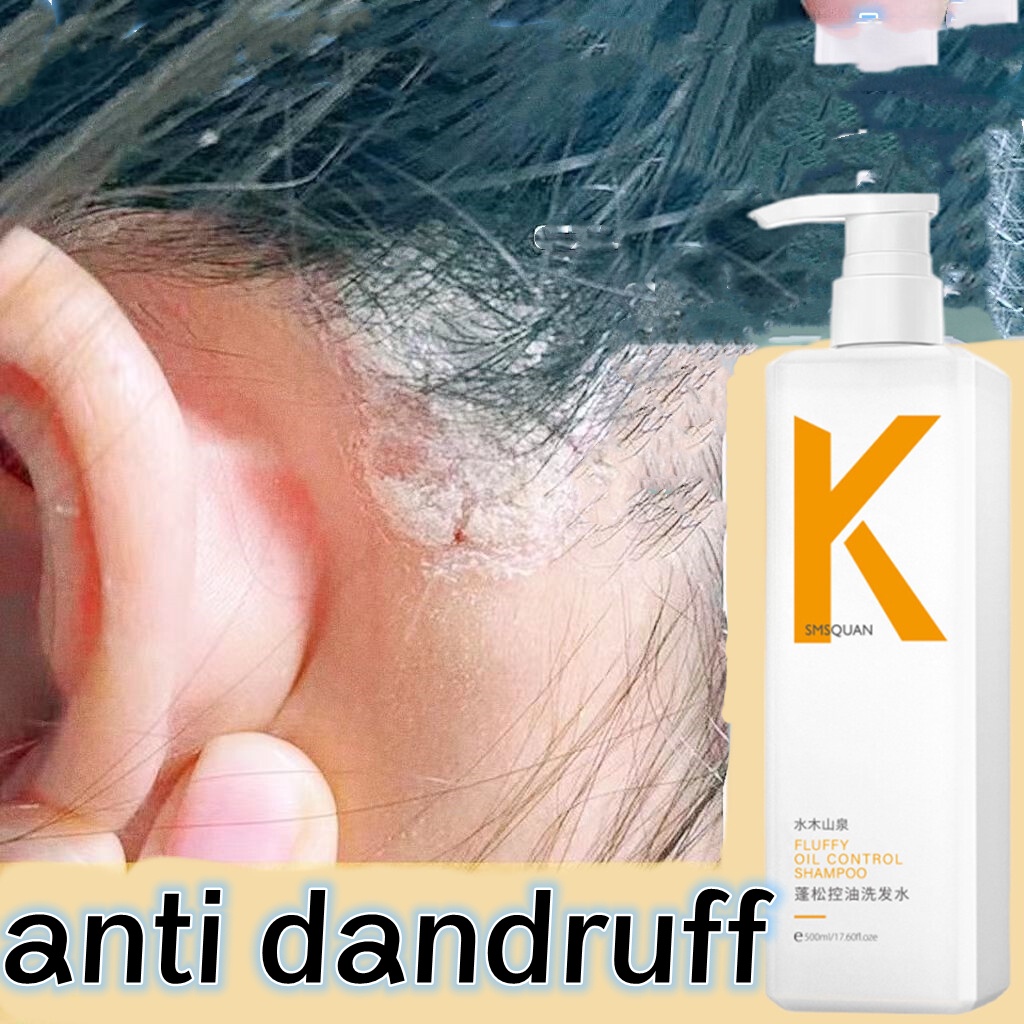 shampoo kelemumur ubat kelemumur kepala syampoo kelemumur anti dandruff