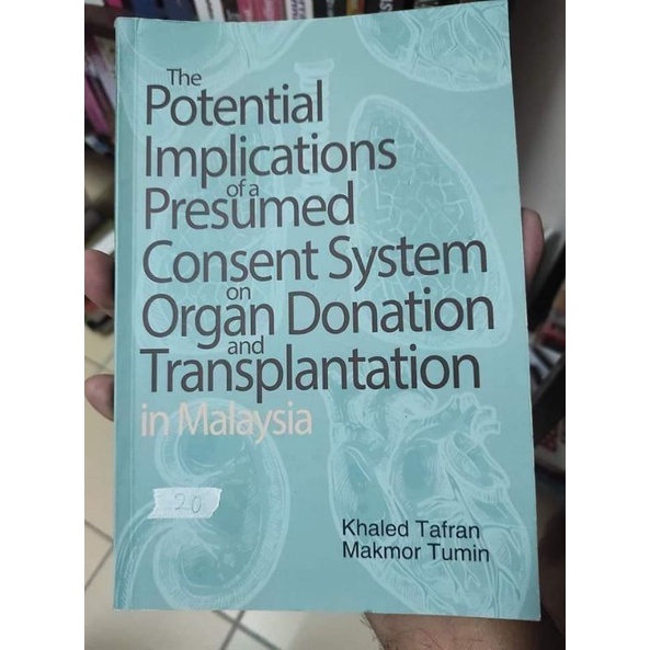 the potential implications of presumed consent system on organ donation & transplantation in Malaysia