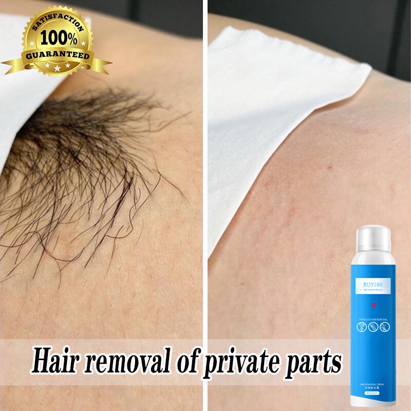 Permanent hair remover Hair removal spray private parts 脫毛膏除毛膏永久私密處 Armpit  dimples depilatory cream for men and women | Shopee Malaysia