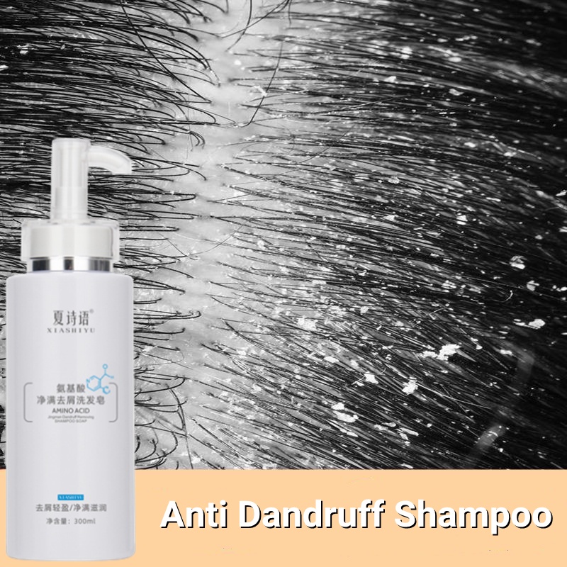 Amino Acid Shampoo Kelemumur Anti Dandruff Syampoo Kulit Kepala