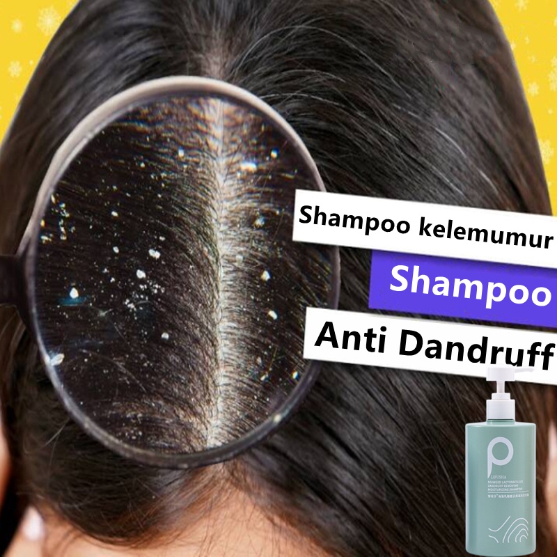 shampoo kelemumur Anti Dandruff Shampoo scalp itching treatment