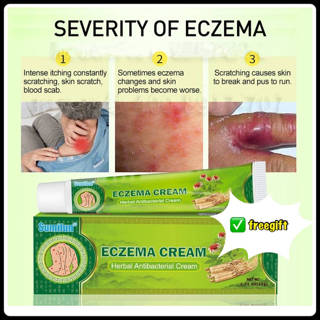 Ubat Gatal Kulit Ekzema Berkesan Eczema Ubat herba cina Psoriasis