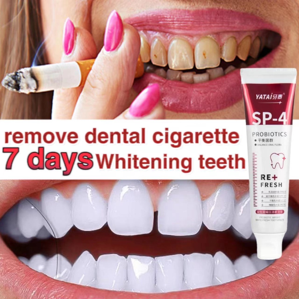 pemutih gigi kuning ubat gigi pemutih Whitening Toothpaste Probiotics