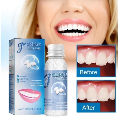 💥💥💥 PROMOSI!!Diy Gigi Palsu Temporary Tooth Repair Kit Teeth And Gaps FalseTeeth Solid Glue 假牙胶囊 假牙牙胶
