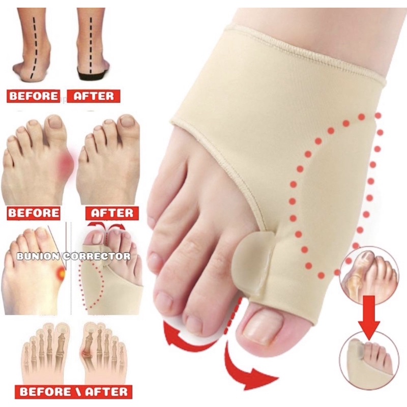 Bunion Corrector Big Toe Splint Straightener Correction Hallux Valgus