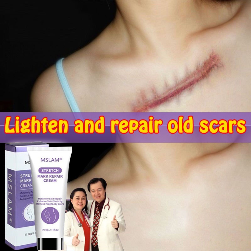 scar removal cream Pregnancy Repair Cream stretch mark cream Acne Treatment Repairing Fat Striae