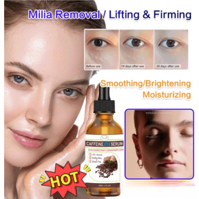 Milia Removal Essence Fat Granule Eye Essence Shopee Malaysia