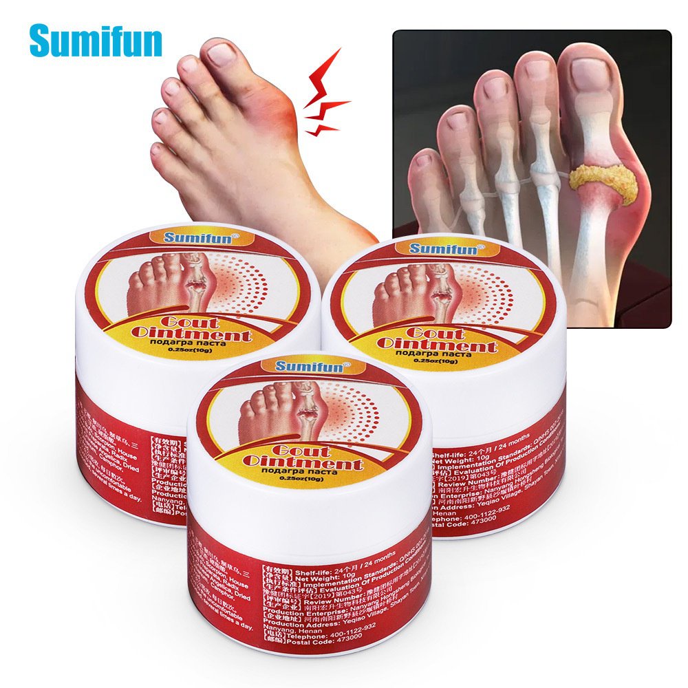 Sumifun rawatan Gout salap bersama Hallux Valgus Pain Relief Arthritis ...