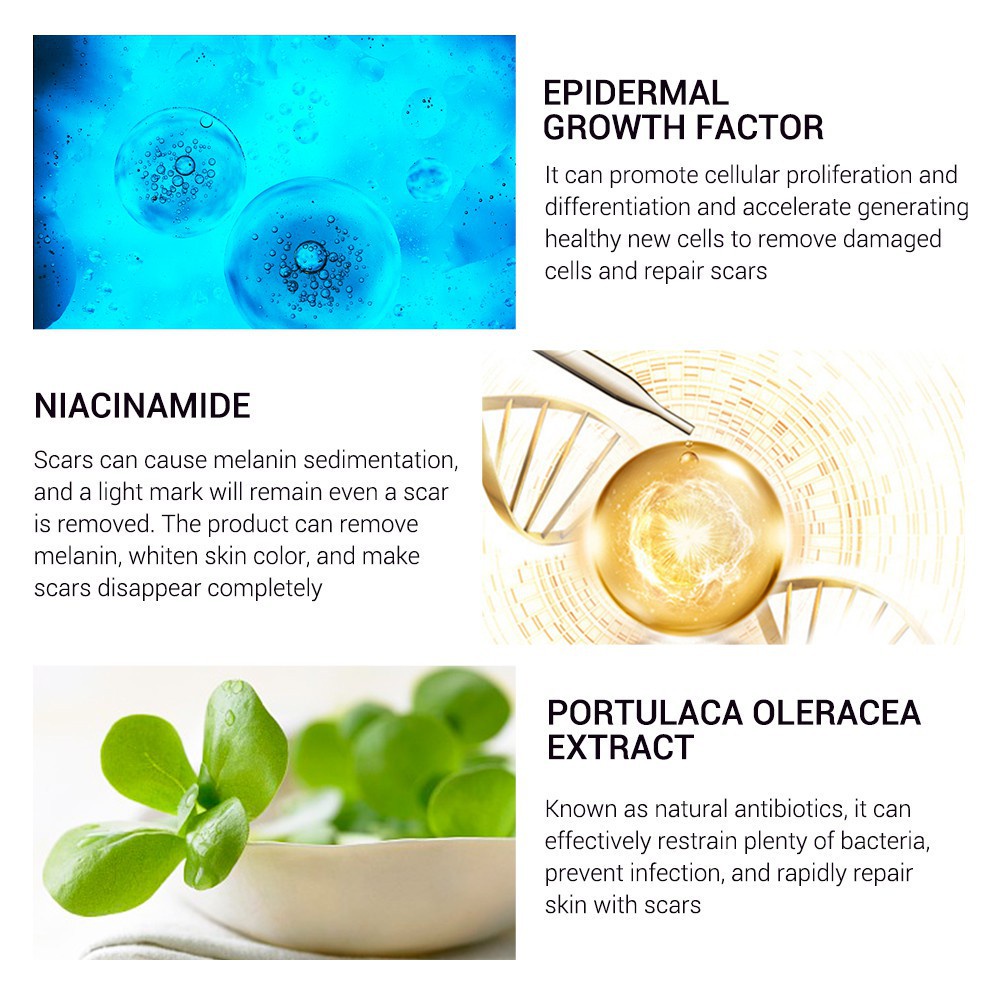 Essential Quality Ready stock ! BREYLEE Scar Removal Cream Treatment Remove Stretch Marks Whitening (30g) Versatile - Image 4