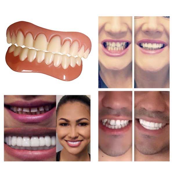 Must Multi Snap Fake Teeth Set | Gigi Palsu Kosmetik Segera - Image 3