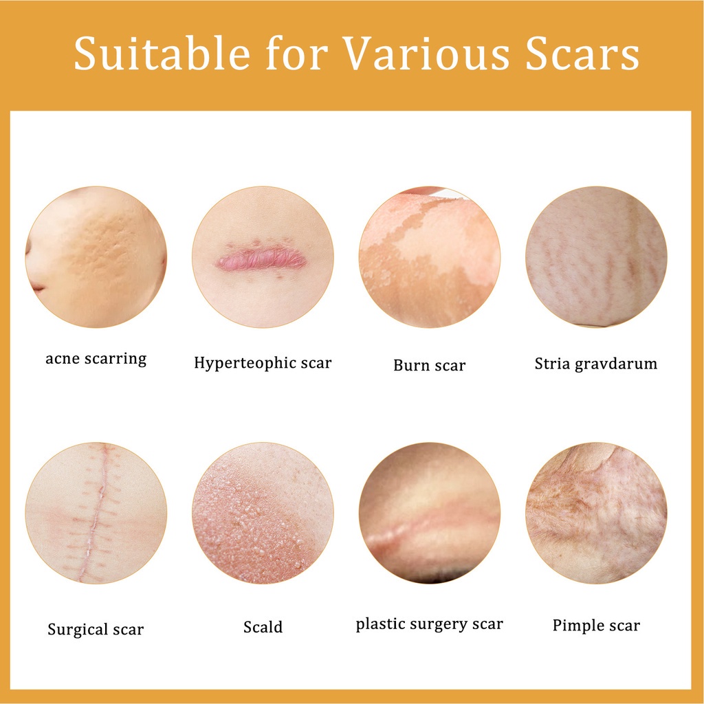 Durable Have Skin Scar Repair Cream Wounds Burn Desiccation Operation Premium - Image 2