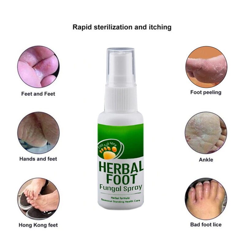 Must Premium Kaki Gatal Berbau Spray Kulat Makan Air Foot Deodorant Fungus Antibacterial Herbal - Image 2