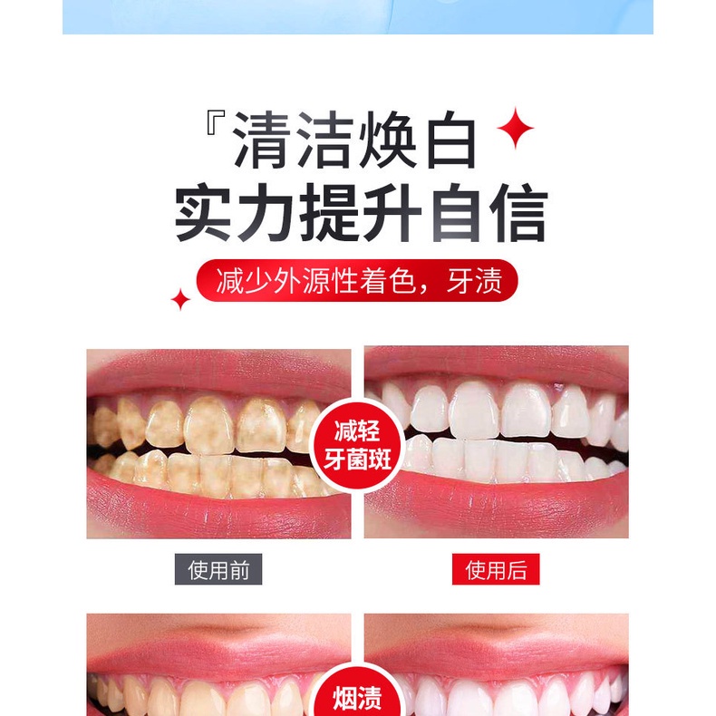 Premium Reliable Probiotics Whitening Toothpaste Oral Care Fresh Breath Remove Stains Whiten Teeth Shark - Image 5