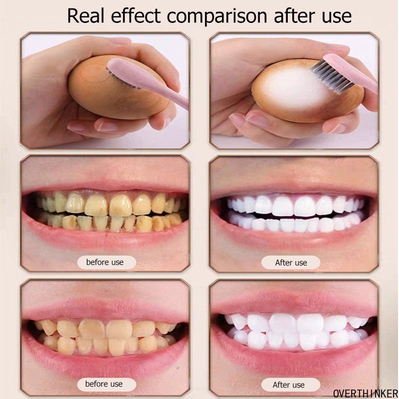 Premium Versatile Ubat Gigi Teeth Whitening Putih Toothpaste White Fresh Breath Niacinamide Toothpaste100g - Image 4