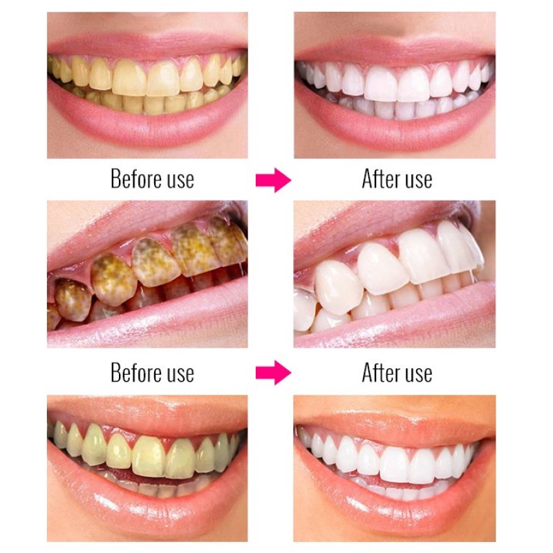 Must Durable Niacinamide Whitening Toothpaste Teeth White Fresh Breath Quality - Image 3
