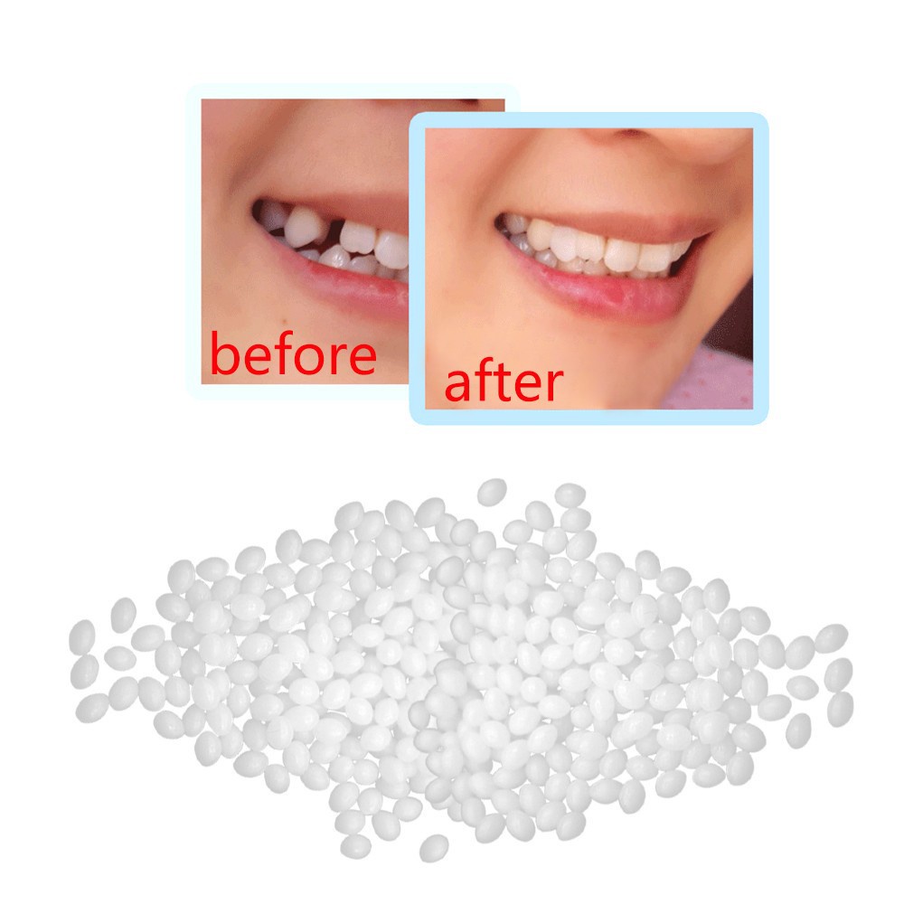 Must Purpose 10g Resin FalseTeeth Solid Glue Temporary Tooth Repair Set Vampire Teeth 假牙固体胶 牙齿临时修... - Image 5