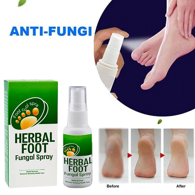 Must Premium Kaki Gatal Berbau Spray Kulat Makan Air Foot Deodorant Fungus Antibacterial Herbal - Image 5