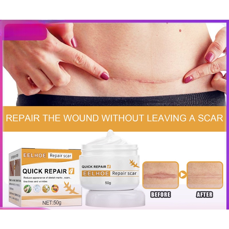 Durable Have Skin Scar Repair Cream Wounds Burn Desiccation Operation Premium - Image 3
