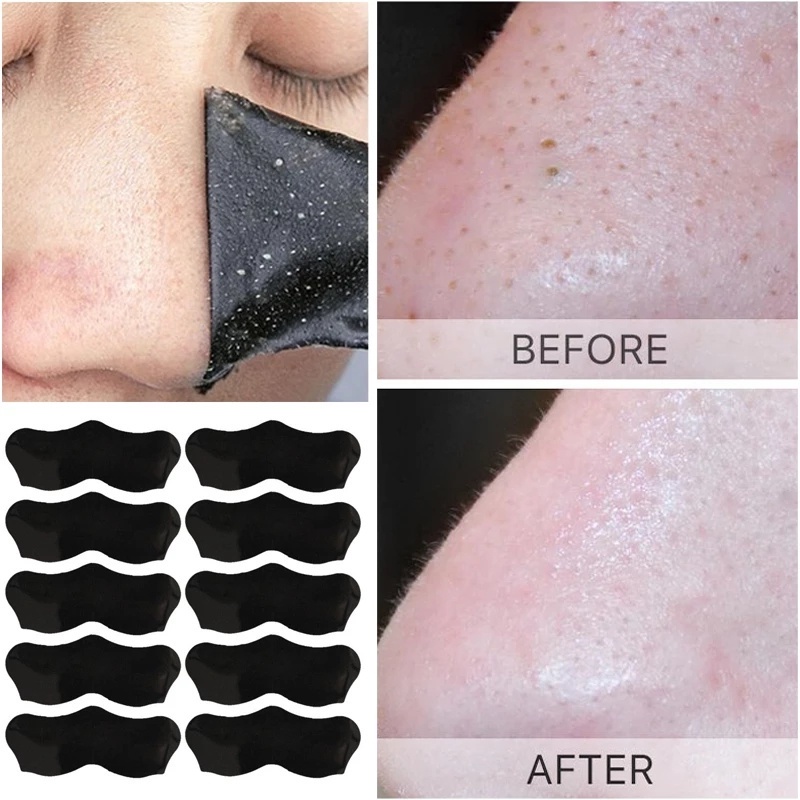 Have Versatile 10PCS Nose Blackhead Remover Mask Deep Cleansing Skin Care Shrink Pore Acne Treatment Black dots Clean... - Image 5