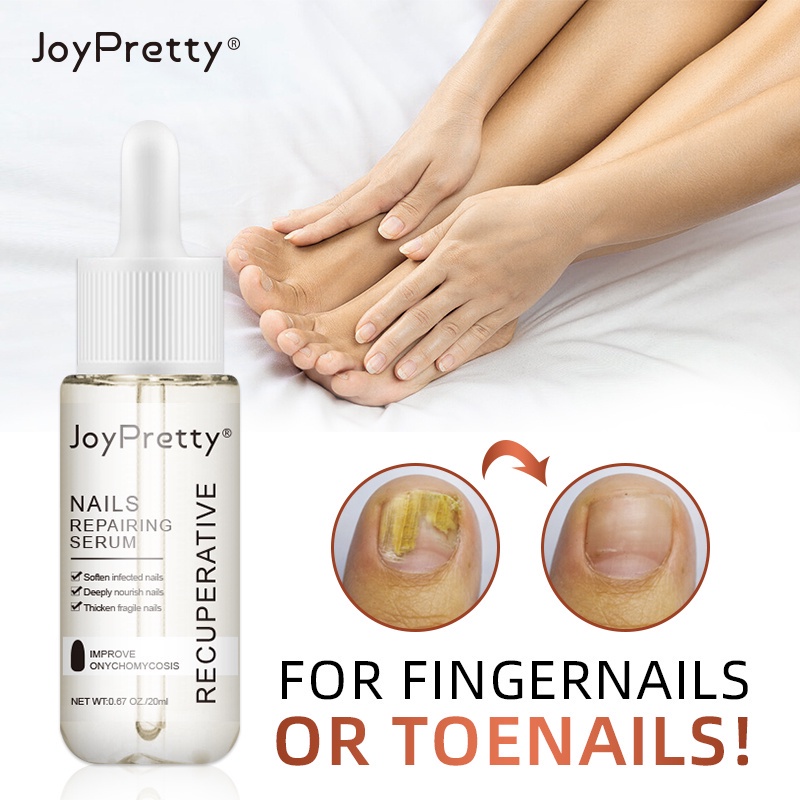 Must Durable Fungus-Free Nails & Toes: Revitalize Whiten JOYPRETTY Care Elixir! - Image 5