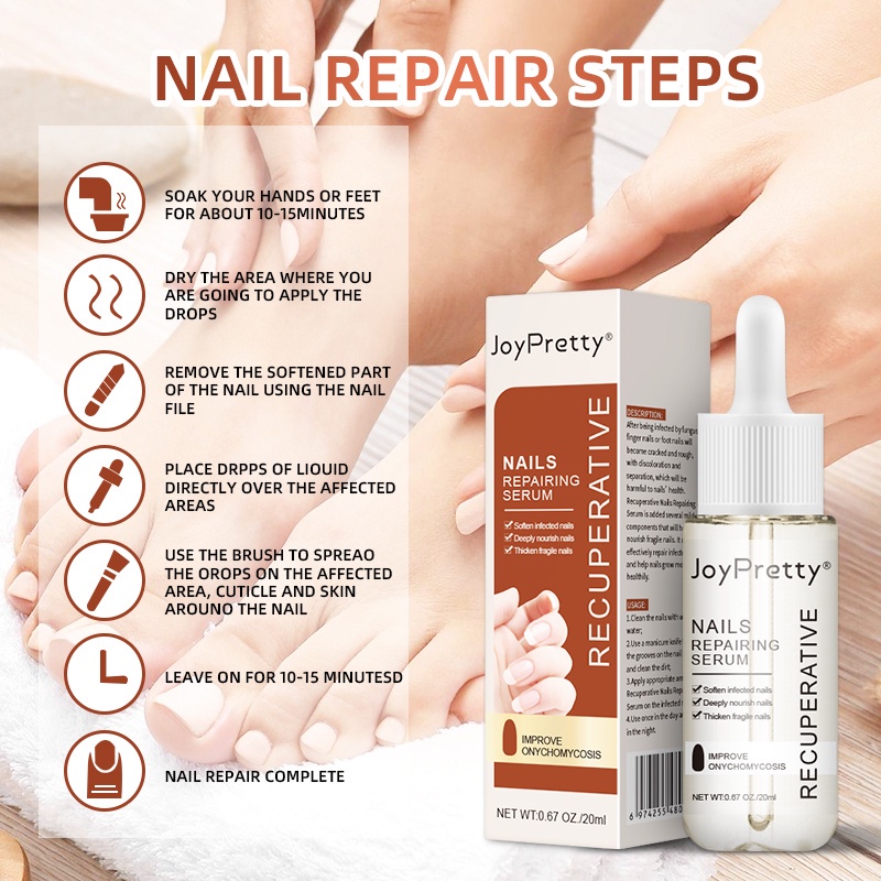 Fungus-Free Nails & Toes: Revitalize and Whiten with JOYPRETTY Care Elixir!