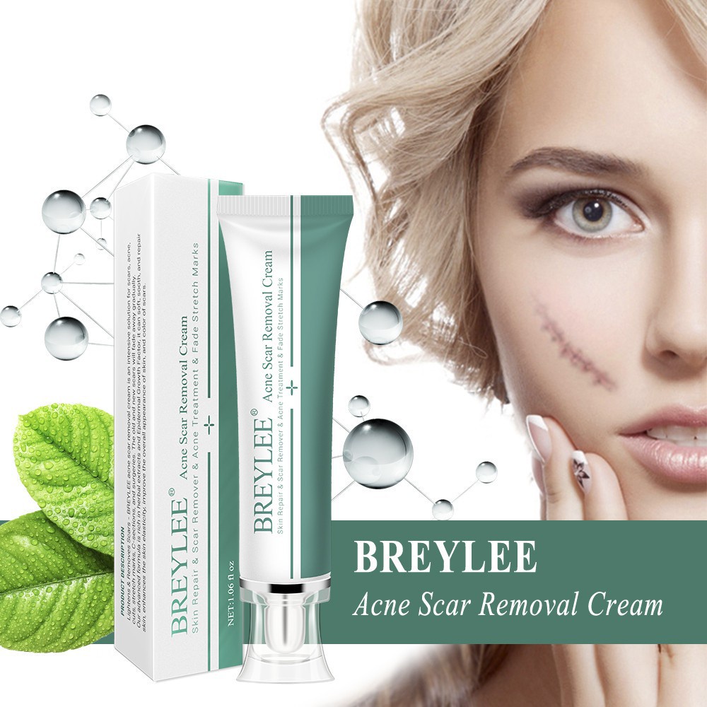 Essential Quality Ready stock ! BREYLEE Scar Removal Cream Treatment Remove Stretch Marks Whitening (30g) Versatile