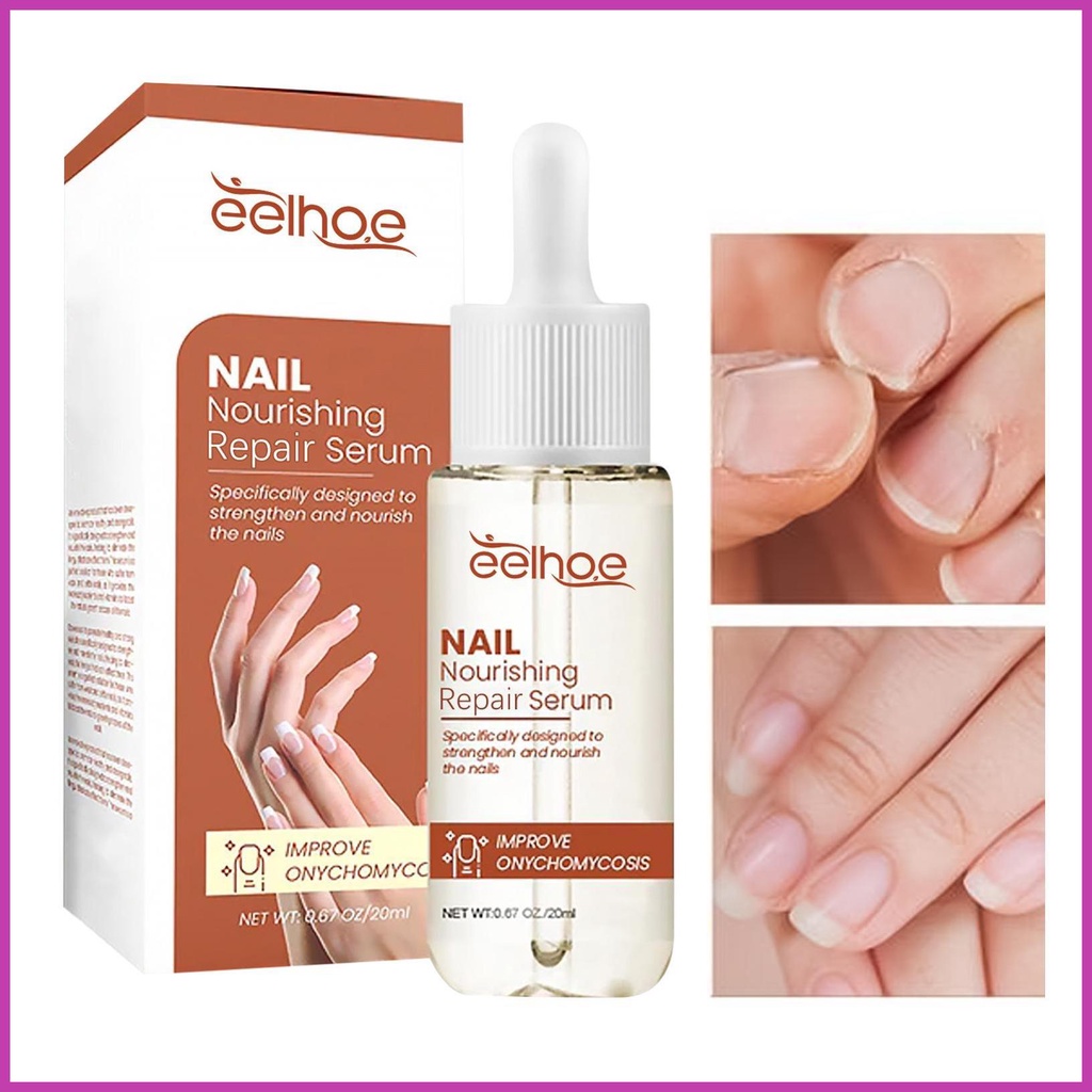 Nail Strengthener Nail Repair Nail Care Essence Providing Rich Nutrition And Aiding In Nail Repair Nail Care wsdmy wsdmy