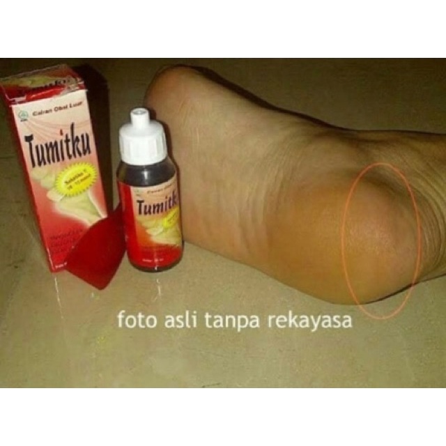 Durable Essential My Tumitku Overcoming Broken Legs Ship Instant 30ml Premium Reliable - Image 5