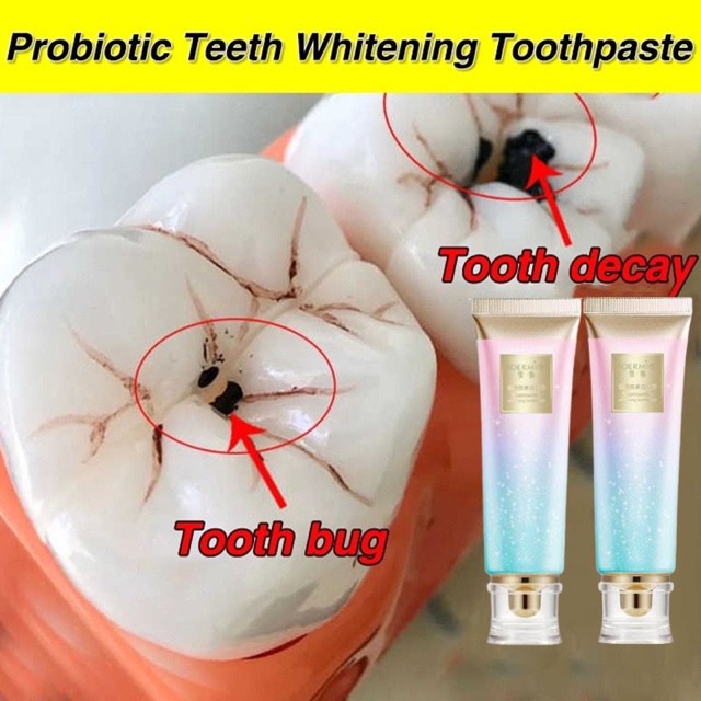 Durable Must Xuemi Niacinamide Whitening Toothpaste 100g Stain Remove Yellowing Fresh Breath Clean Teeth Oral Gum Car... - Image 2
